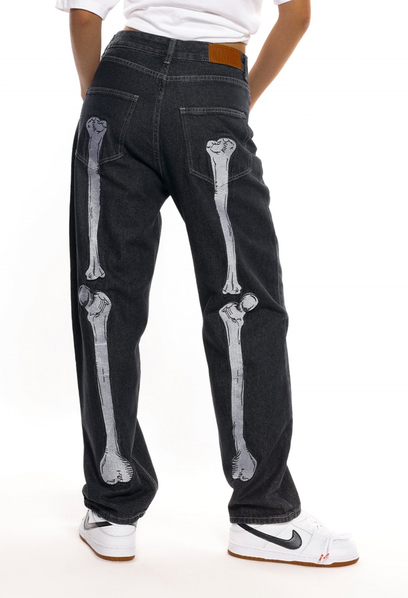 Noir  Jean Aelfric Eden Vintage Skull Bone Embroidery - CIG-4978641